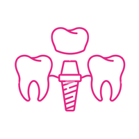 dental-implants